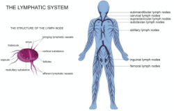 lymphedema-300x199